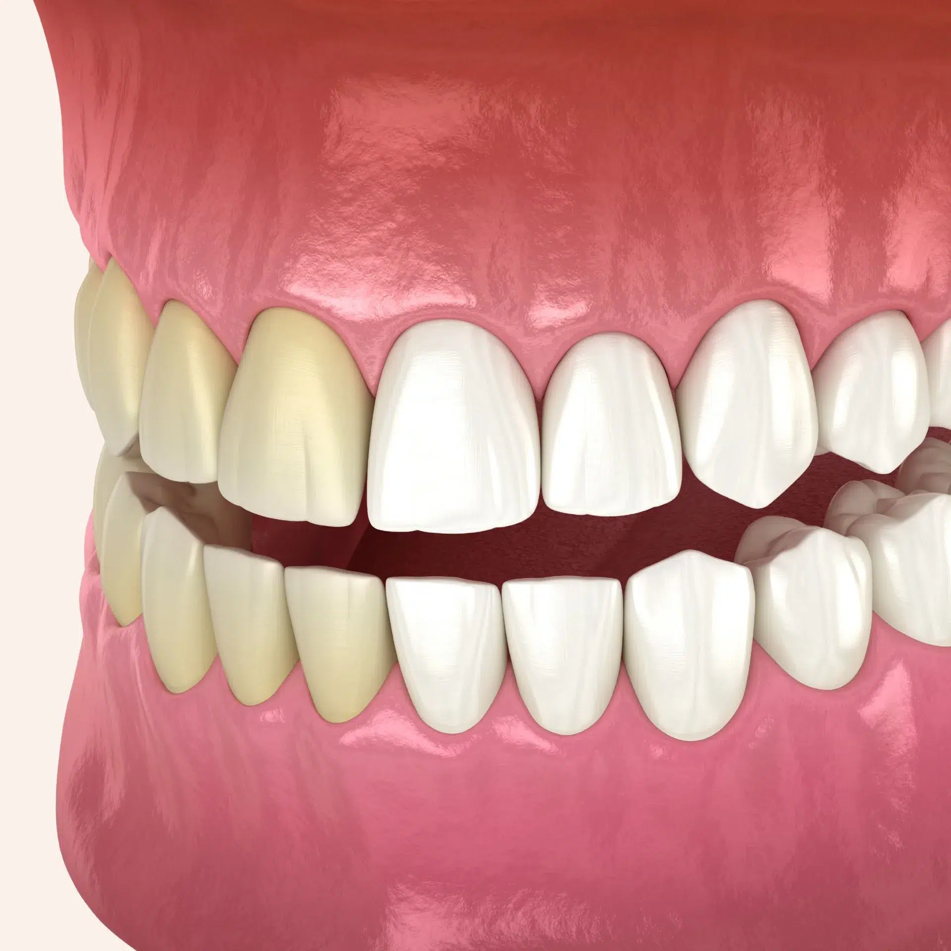 Cosmetic dentist in Loudoun providing safe and effective teeth whitening treatment