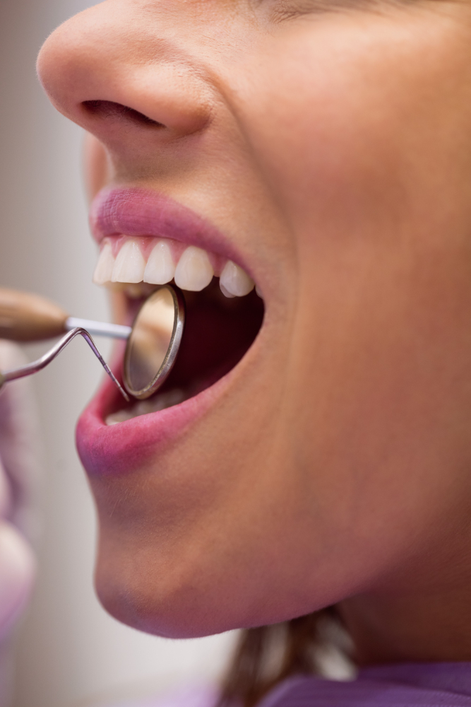 “Close-up of a patient’s mouth showing clean, healthy teeth after dental treatment at Loudoun Family & Cosmetic Dentistry in Leesburg, VA. “Close-up of a patient’s mouth showing clean, healthy teeth after dental treatment at Loudoun Family & Cosmetic Dentistry in Leesburg, VA.