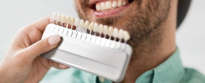 Understanding Veneers: Your Guide to a Perfect Smile